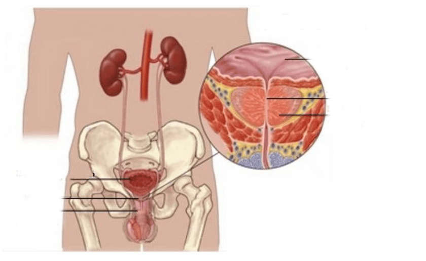prostatite em homens