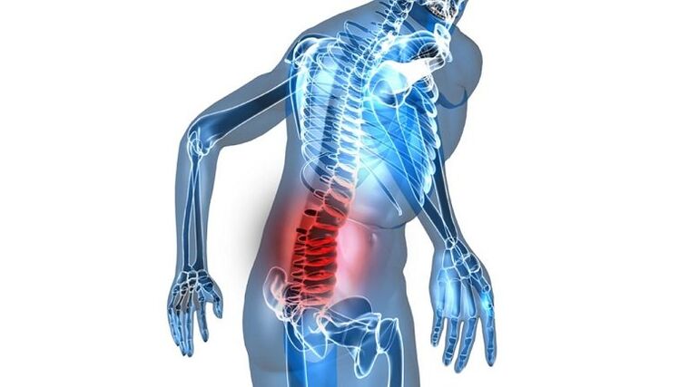 Inflamação com prostatite congestiva