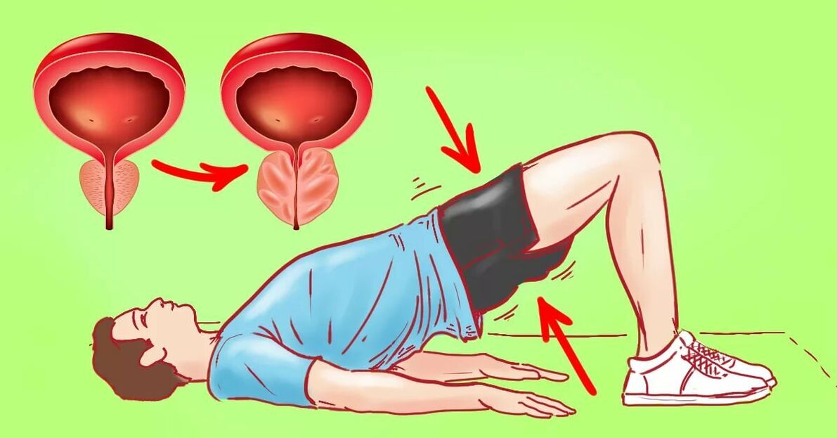 Exercícios para prostatite
